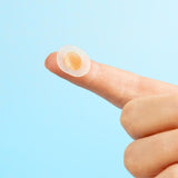 Bye Bye Blemish Microneeding Acne Patches
